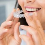 The Transformative Power of Teeth Straightening for Your Smile