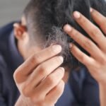 Three Treatment Options for Male Pattern Baldness